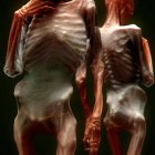 Artistic skeleton figures with human-like poses and muscle fibers on dark background, one holding a skull with