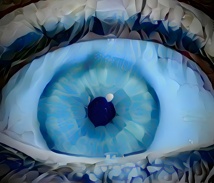 Eye