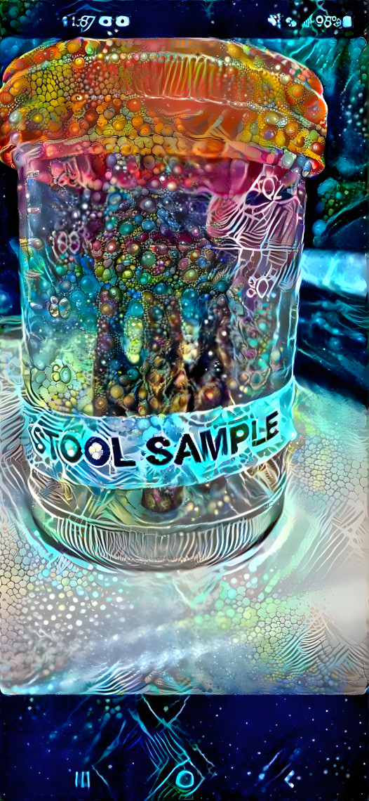 stool sample