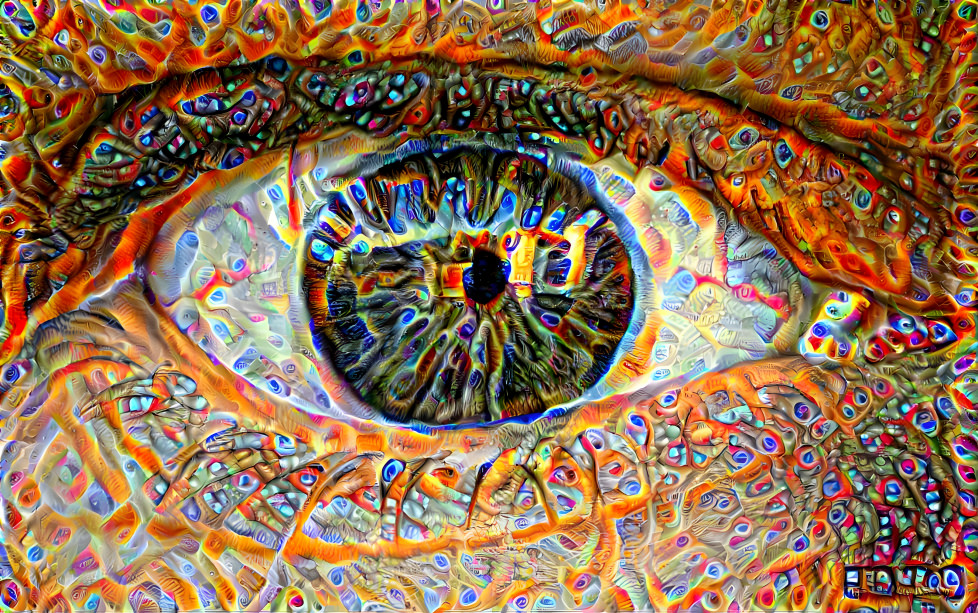 My Eye through the AI! 