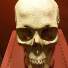 Human skull on stand with cranial suture and dentition against red background