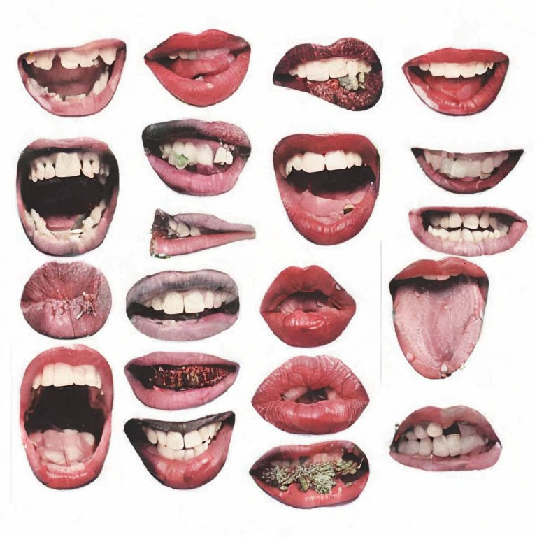 Assortment of mouths with different dental conditions