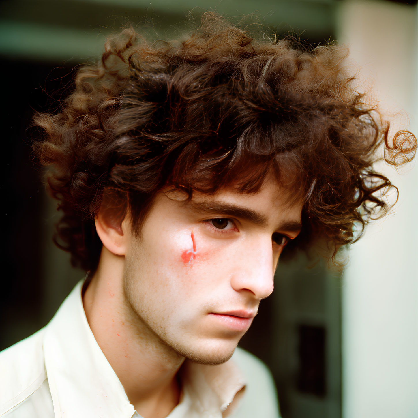 Young man with curly hair and serious expression with small cut under left eye