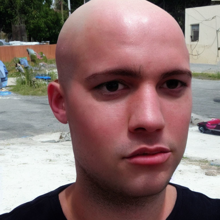 Bald person with fair skin and stubble in black shirt, serious expression, outdoor background