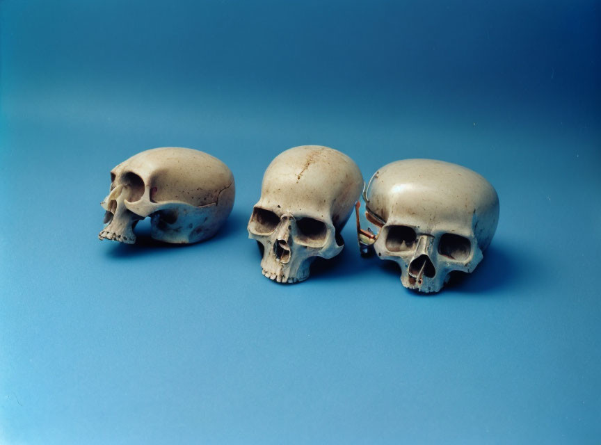 Three human skull models on blue background display.