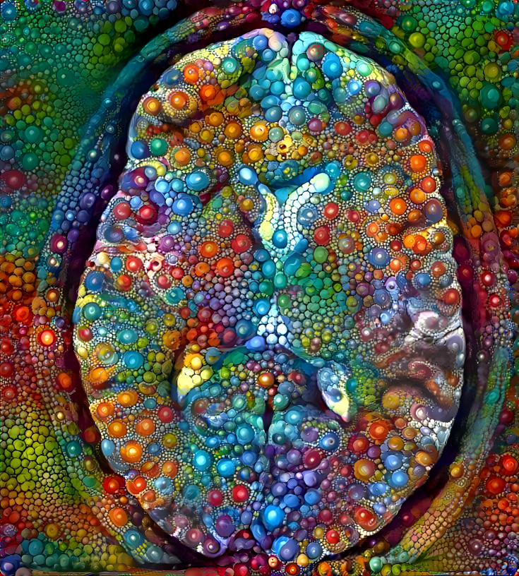 brain MRI1